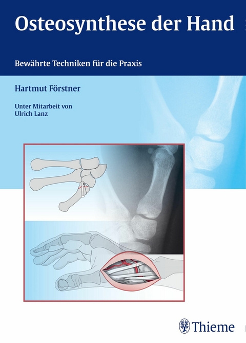 Osteosynthese der Hand -  Hartmut F&ouml;rstner