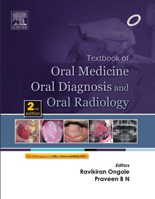 Textbook of Oral Medicine, Oral Diagnosis and Oral Radiology - E-Book