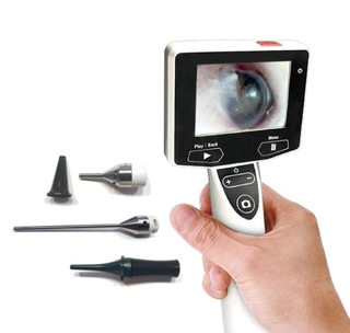 Digitales Video Otoskop