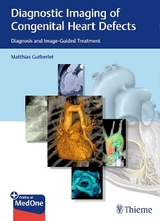 Diagnostic Imaging of Congenital Heart Defects - 