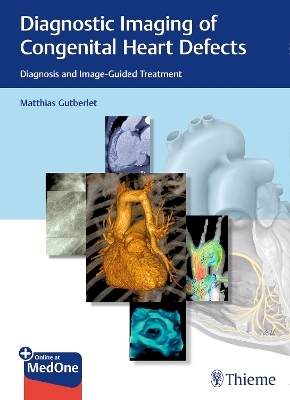 Diagnostic Imaging of Congenital Heart Defects - 