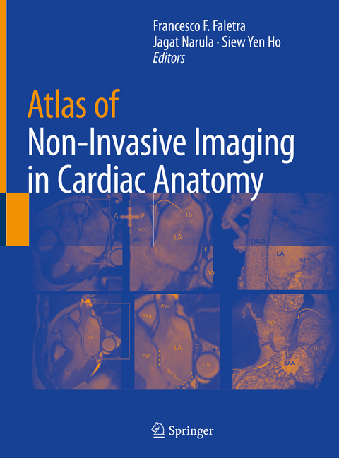 Atlas of Non-Invasive Imaging in Cardiac Anatomy - 