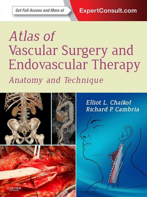 Atlas of Vascular Surgery and Endovascular Therapy E-Book -  Elliot L. Chaikof