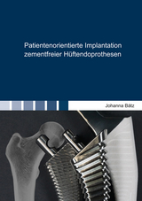 Patientenorientierte Implantation zementfreier H&uuml;ftendoprothesen - Johanna B&auml;tz