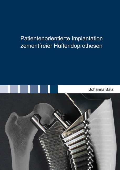 Patientenorientierte Implantation zementfreier H&uuml;ftendoprothesen - Johanna B&auml;tz
