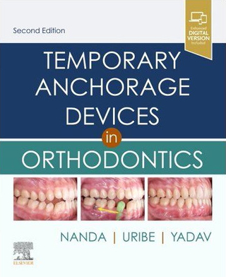 Temporary Anchorage Devices in Orthodontics