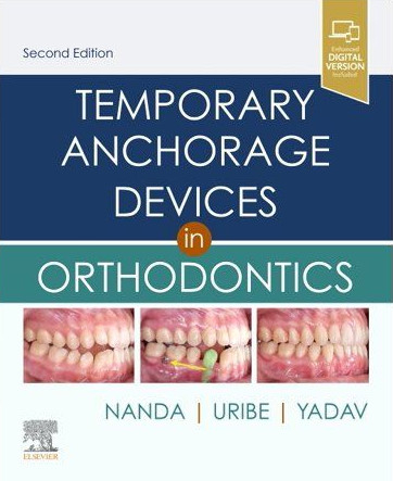 Temporary Anchorage Devices in Orthodontics - 