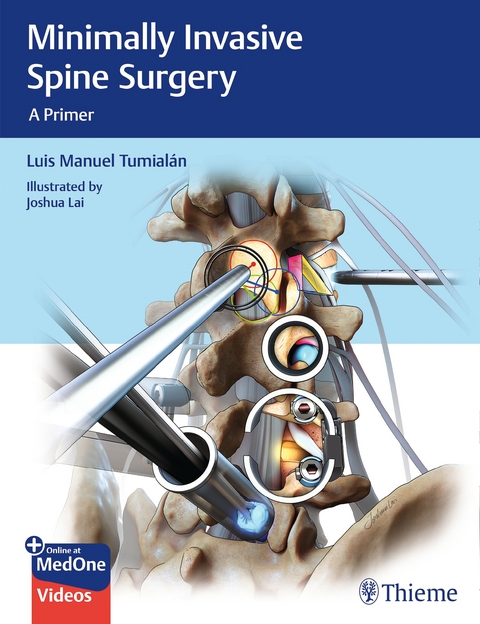 Minimally Invasive Spine Surgery - Luis M. Tumialan