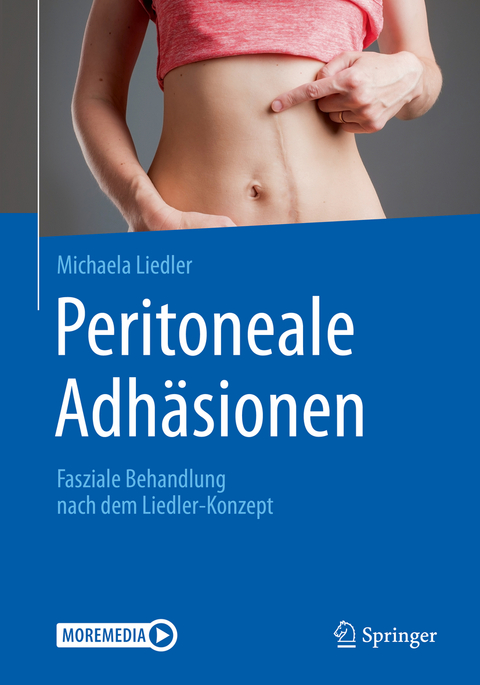 Peritoneale Adh&auml;sionen - Michaela Liedler