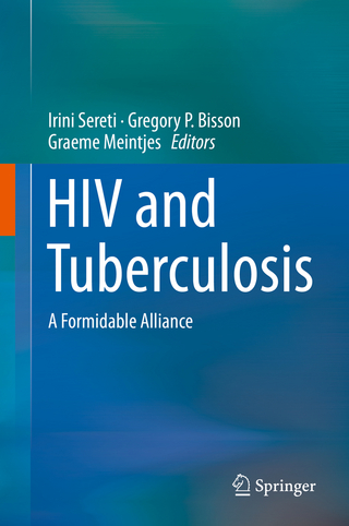 HIV and Tuberculosis
