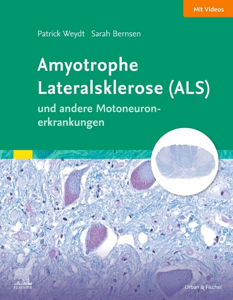 Elsevier Essentials ALS und andere Motoneuronerkrankungen - Patrick Weydt