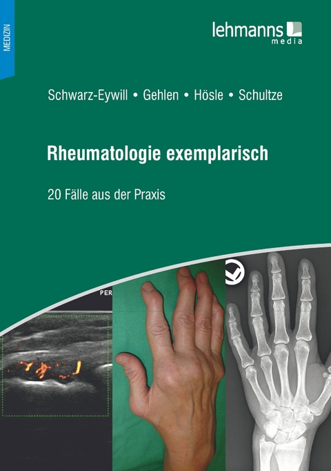 Rheumatologie exemplarisch - Michael Schwarz-Eywill, Martin Gehlen, Rosmarie H&ouml;sle, Mareen Schultze