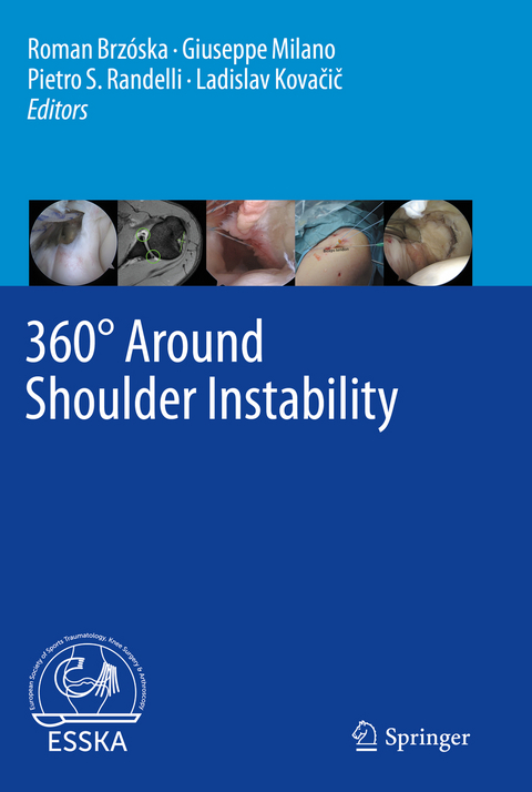 360&deg; Around Shoulder Instability - 