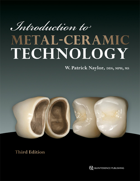 Introduction to Metal-Ceramic Technology - W Patrick Naylor
