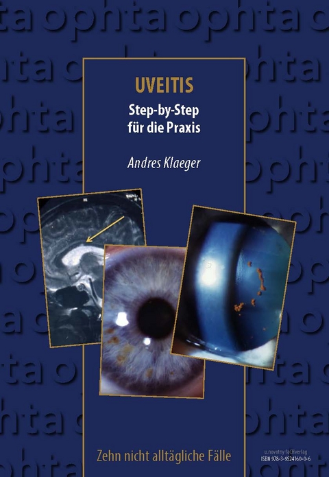 Uveitis - Andres Klaeger