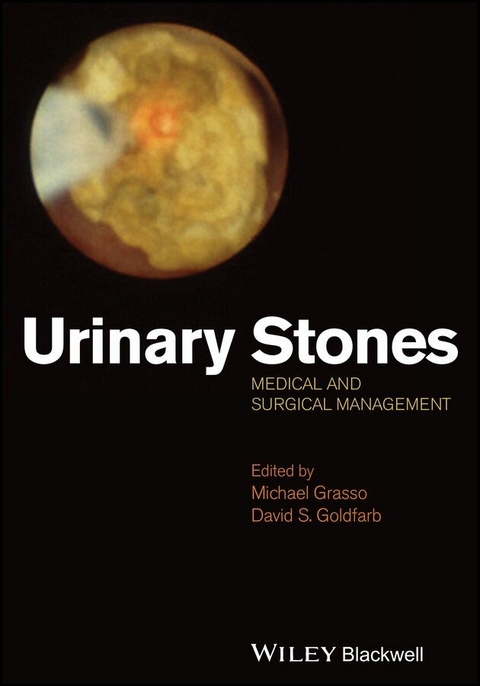 Urinary Stones - 