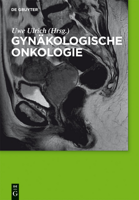 Gyn&auml;kologische Onkologie - 