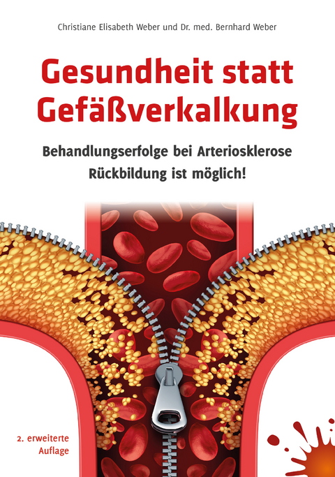 Gesundheit statt Gef&auml;&szlig;verkalkung - Dr. med. Bernhard Weber, Christiane E. Weber