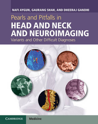 Pearls and Pitfalls in Head and Neck and Neuroimaging -  Nafi Aygun,  Dheeraj Gandhi,  Gaurang Shah