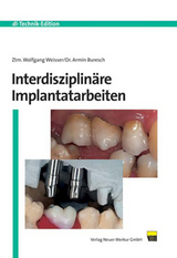 Interdisziplin&auml;re Implantatarbeiten - Wolfgang Weisser, Armin Buresch