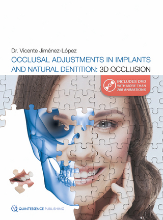 Occlusal Adjustments in Implants and Natural Dentition