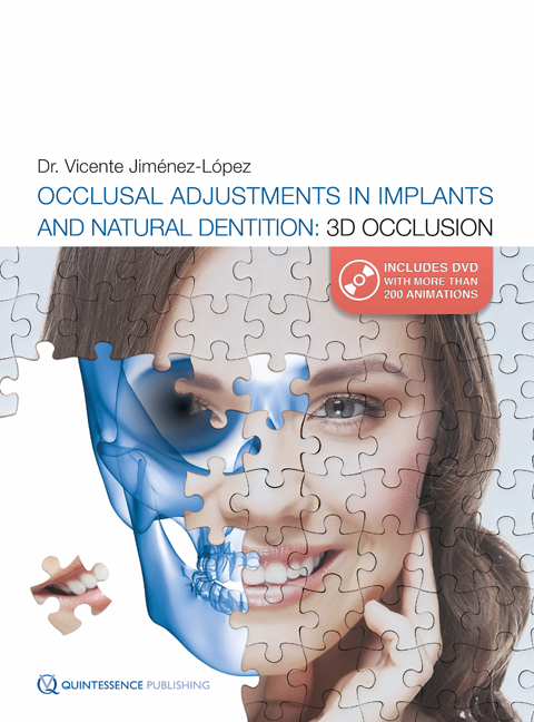 Occlusal Adjustments in Implants and Natural Dentition - Dr. Vicente Jimenez-Lopez