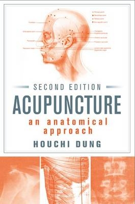 Acupuncture