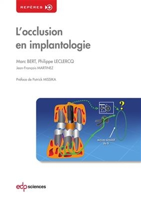 L'occlusion en implantologie - Marc Bert, Philippe Leclercq, Jean-F Martinez