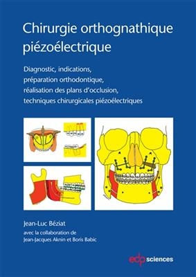 Chirurgie orthognatique piézoélectrique : diagnostic, indications, préparation orthodontique, réalisation des plans d...