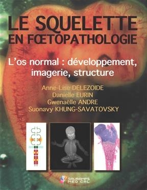 Le squelette en foetopathologie : l'os normal : d&eacute;veloppement, imagerie, structure -  DELEZOIDE/EURIN ETC.