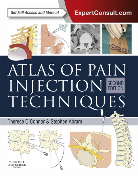 Atlas of Pain Injection Techniques E-Book -  Stephen E. Abram,  Therese C. O'Connor