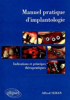 Manuel pratique d'implantologie : indications et principes th&eacute;rapeutiques - Alfred Seban
