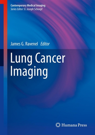 Lung Cancer Imaging