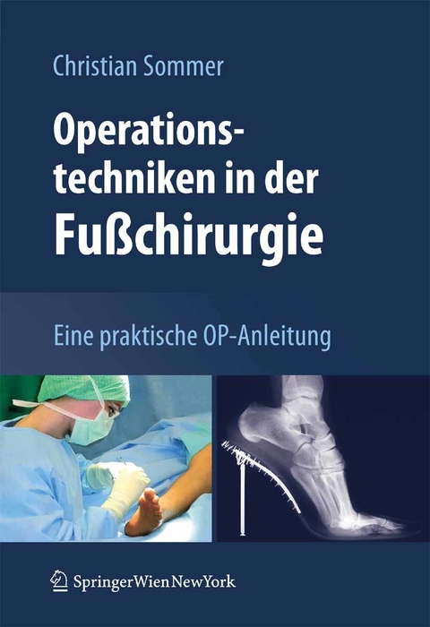 Operationstechniken in der Fu&szlig;chirurgie - Christian Sommer