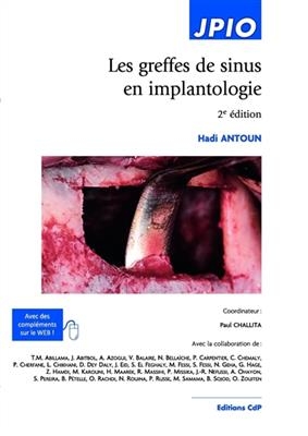 LES GREFFES DE SINUS EN IMPLANTOLOGIE -  ANTOUN HADI