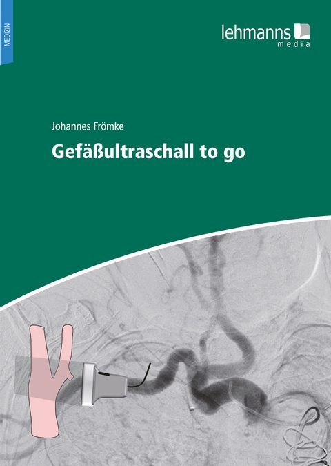 Gefäßultraschall to go - Johannes Frömke