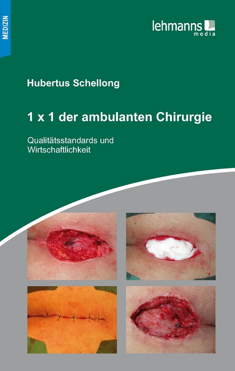 1x1 der ambulanten Chirurgie - Hubertus Schellong