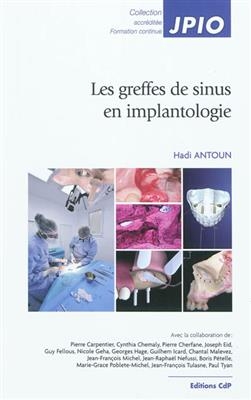 COMBLEMENTS SINUSIENS EN IMPLANTOLOGIE