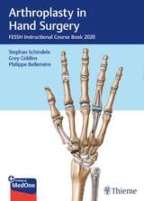 Arthroplasty in Hand Surgery - 