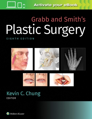 Grabb and Smith's Plastic Surgery