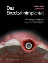 Das Einzelzahnimplantat - Dennis P. Tarnow, Stephen J. Chu