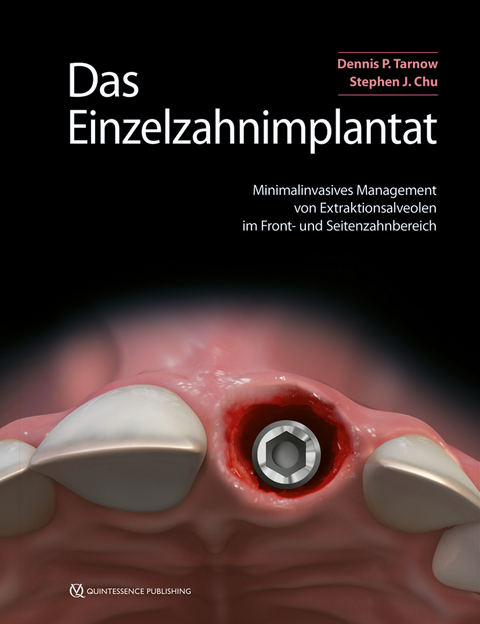 Das Einzelzahnimplantat - Dennis P. Tarnow, Stephen J. Chu