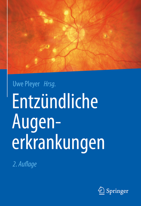 Entz&uuml;ndliche Augenerkrankungen - 