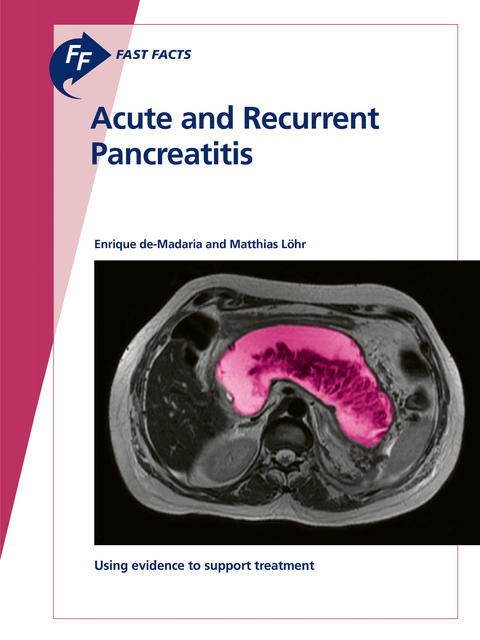 Fast Facts: Acute and Recurrent Pancreatitis - Enrique de-Madaria, Matthias L&ouml;hr