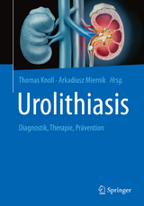 Urolithiasis - 