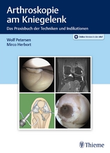 Arthroskopie am Kniegelenk - Wolf Petersen, Mirco Herbort