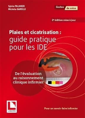 PLAIES ET CICATRISATION GUIDED PRAT IDE -  PALMIER ED 2018