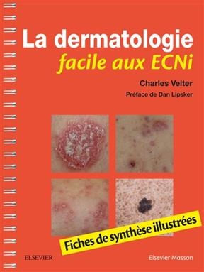 La dermatologie facile aux ECNi : fiches de synth&egrave;se illustr&eacute;es - Charles Velter