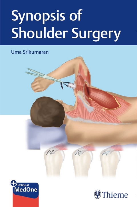 Synopsis of Shoulder Surgery - Uma Srikumaran