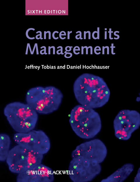 Cancer and its Management - Jeffrey S. Tobias, Daniel Hochhauser